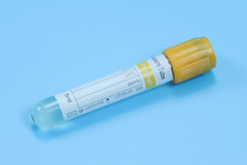 Tubo de v&aacute;cuo do ativador de gel e co&aacute;gulo 